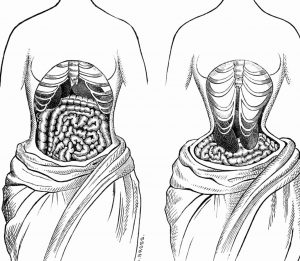 Effects of waist training, before and after.