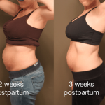 3 weeks postpartum