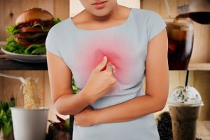 Woman with symptomatic acid reflux