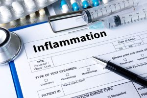Joint inflammation concept medical report